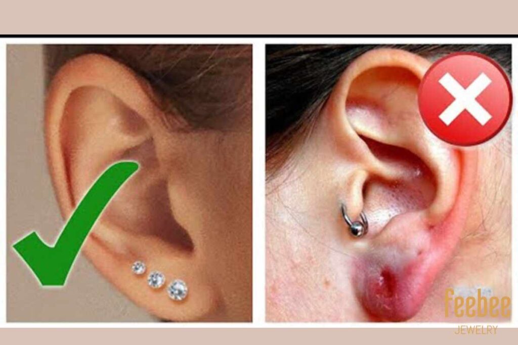 Is surgical steel hypoallergenic? An ultimate guide 2 hypoallergenic ear