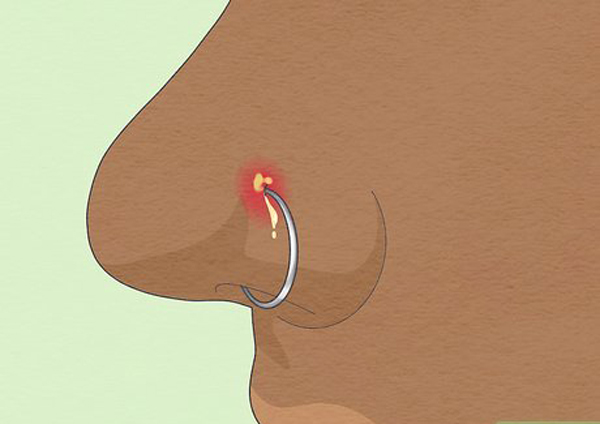 A complete guide to choose the Best Metal for Nose Piercing 7 nose piercing illustration